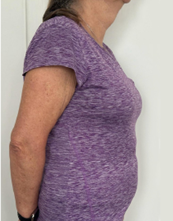 Over 50 senior after health management coaching