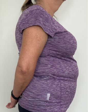 Over 50 senior before health management coaching